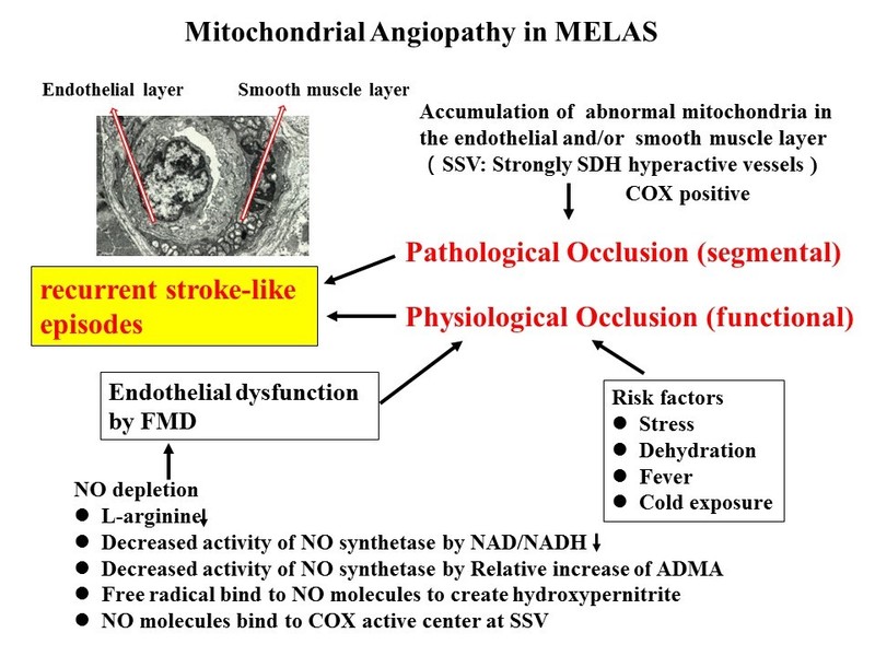 MELAS