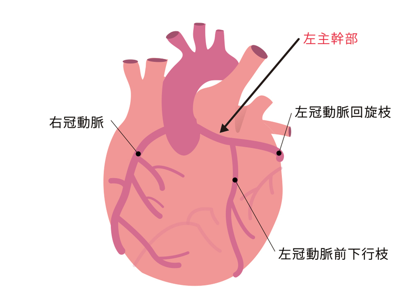 左主幹の位置