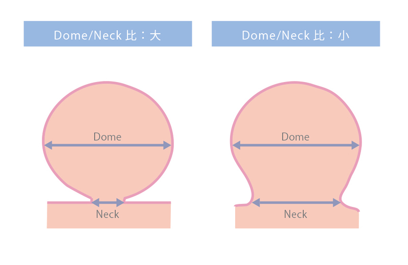 Dome-Neck