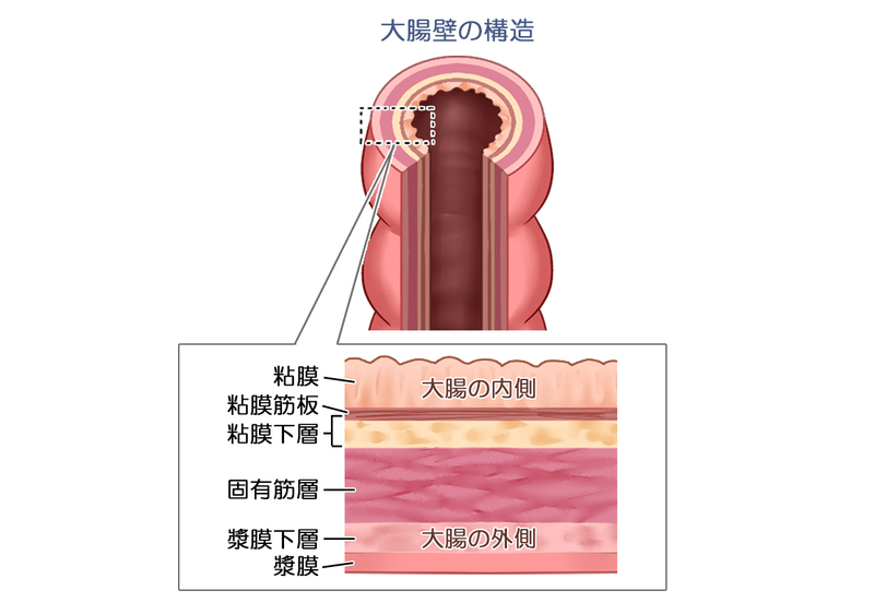 大腸壁の構造