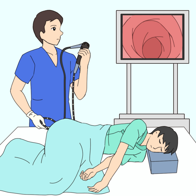 大腸カプセル内視鏡検査