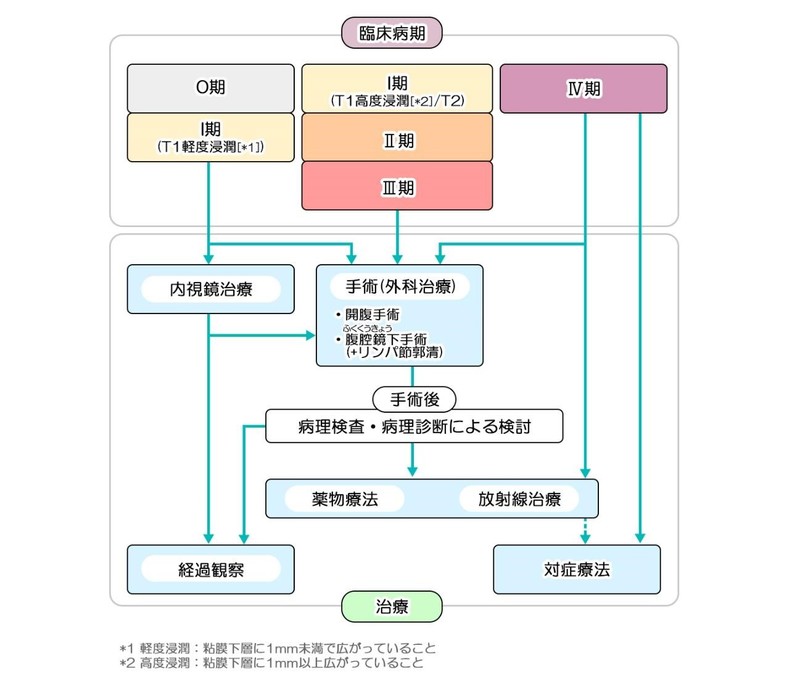 大腸がんにおける治療選択の考え方