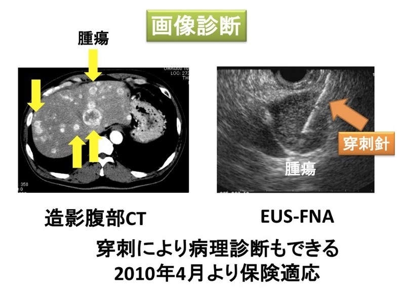 画像診断