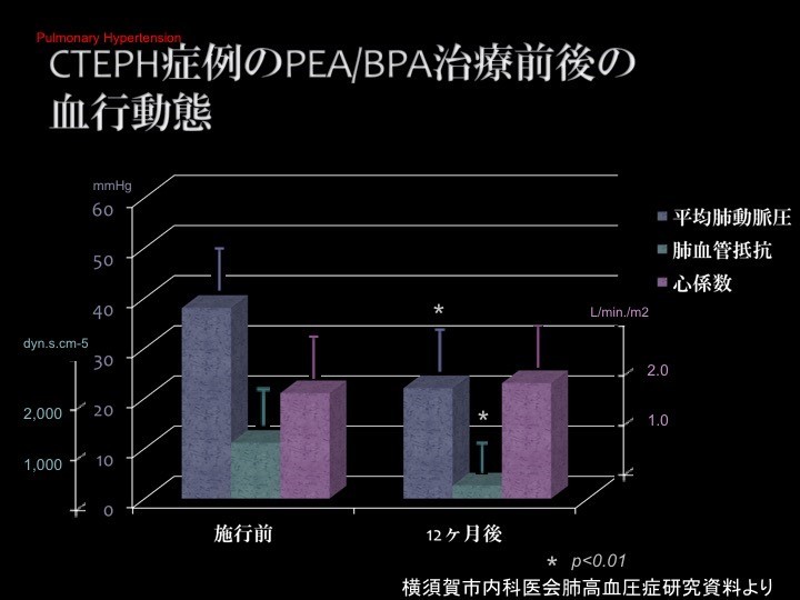 スライド画像/PEA:BPA前後の血行動態.jpg
