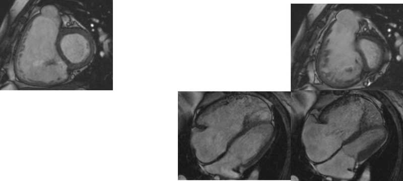 心臓のレントゲン写真