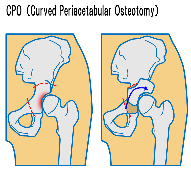 ../CPO.gif