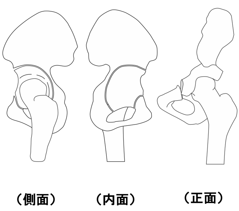 CPO手術後骨の様子