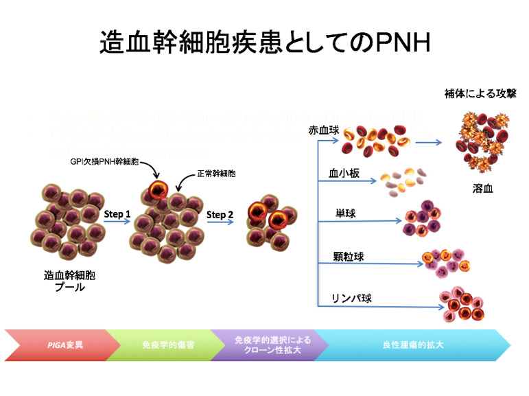 造血幹細胞疾患としてのPNH