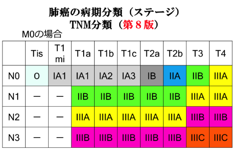 肺がんのステージ分類