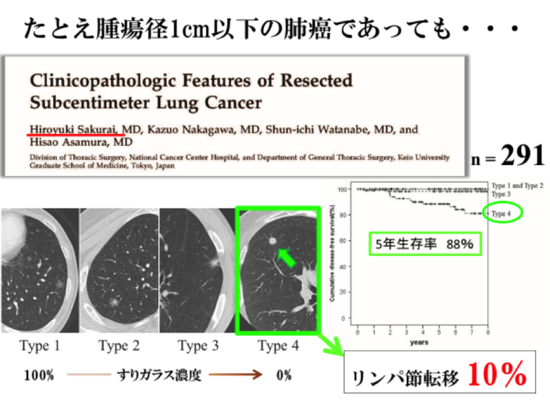 腫瘍の磨りガラス濃度