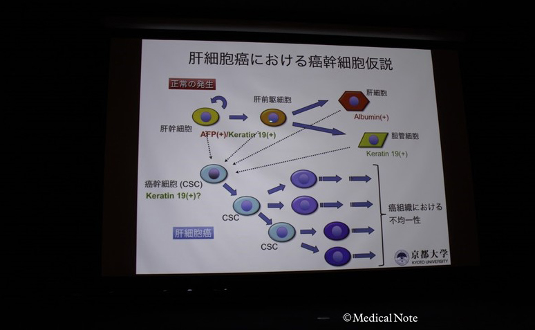 肝細胞がん 仮説