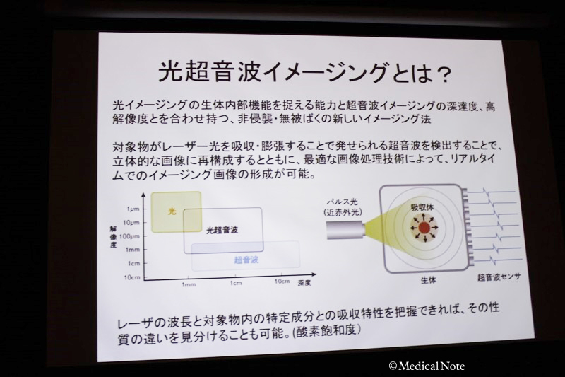 光超音波イメージング