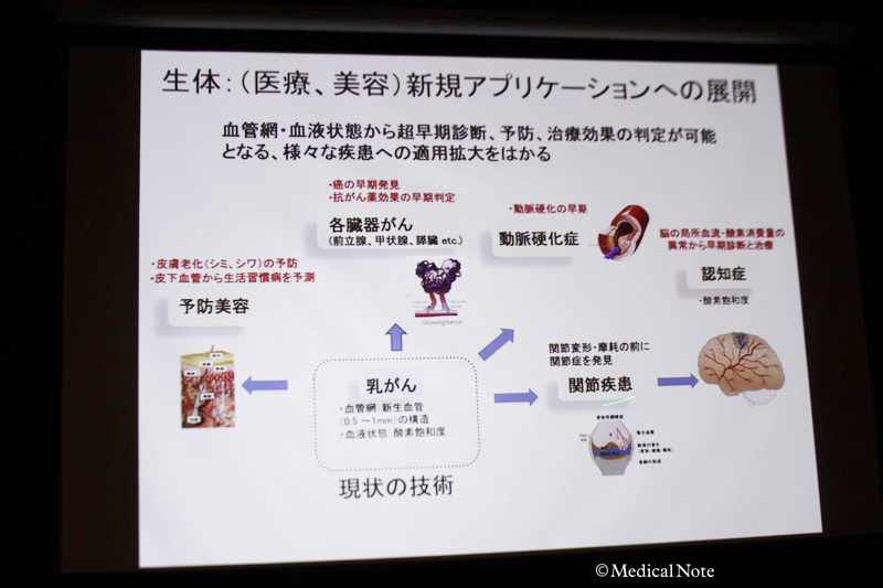 光超音波イメージング あらゆる分野で