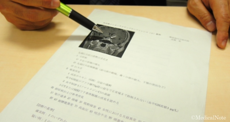 下垂体腺腫の症状-ホルモンの分泌は、過剰でも低下しても体に深刻な影響を及ぼす