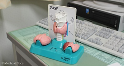 副甲状腺機能亢進症の症状-気づかずに過ごしている人も少なくない
