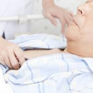 慢性肺アスペルギルス症とは? 肺の病気や過去の結核が誘因となる