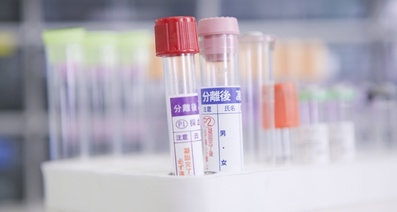 減圧症は様々な検査から総合的に診断する―自己チェックシートの活用も手
