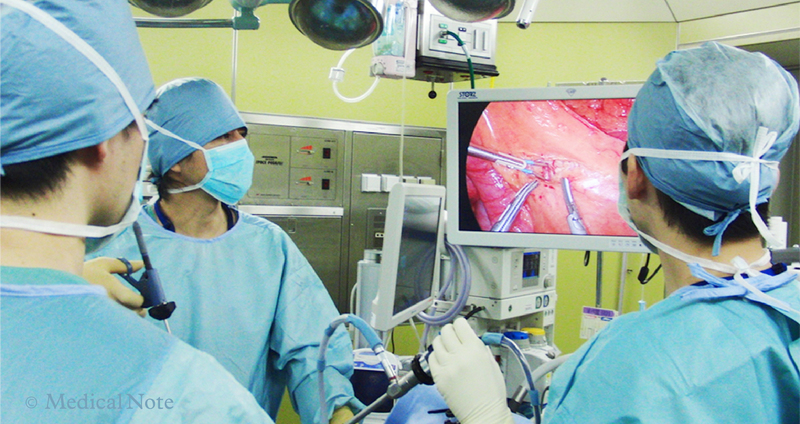 大腸がんとは? 治療方法と腹腔鏡手術というニューノーマル