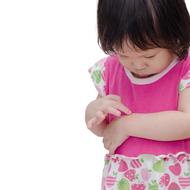 子どもがかかる病気と治療④ 虫さされ/水いぼ/やけど/日焼け/アトピー性皮膚炎/アレルギー性鼻炎・結膜炎