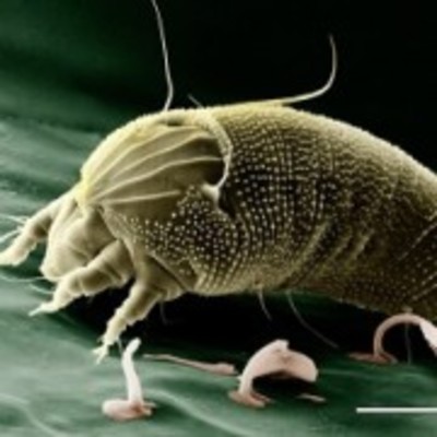 ダニに刺された症状は?跡の写真で見分ける!【特徴,腫れ,対処,痛い】のイメージ