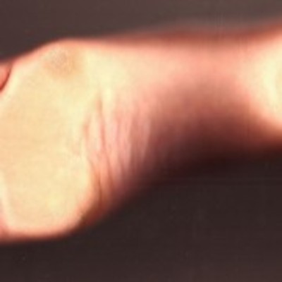 お酢が水虫に効くって本当?自宅で水虫殺菌するには酢?クエン酸?足湯?緑茶?のイメージ