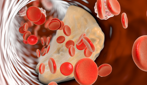 コレステロールのイメージ