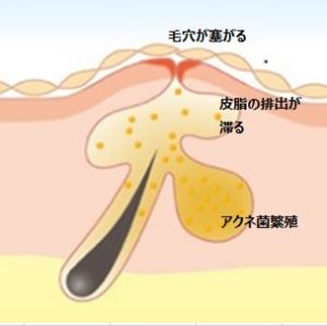 記事番号:70064/アイテムID:2244970の画像