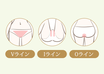 VIO脱毛の施術部位