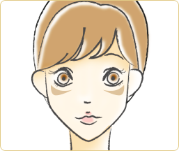 肝斑(かんぱん)