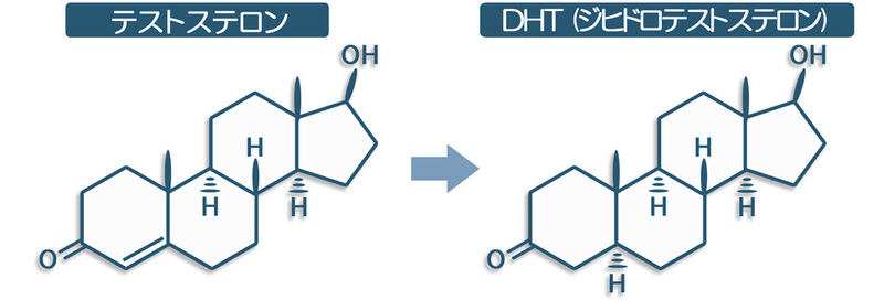 ジヒドロテストステロンテストステロン
