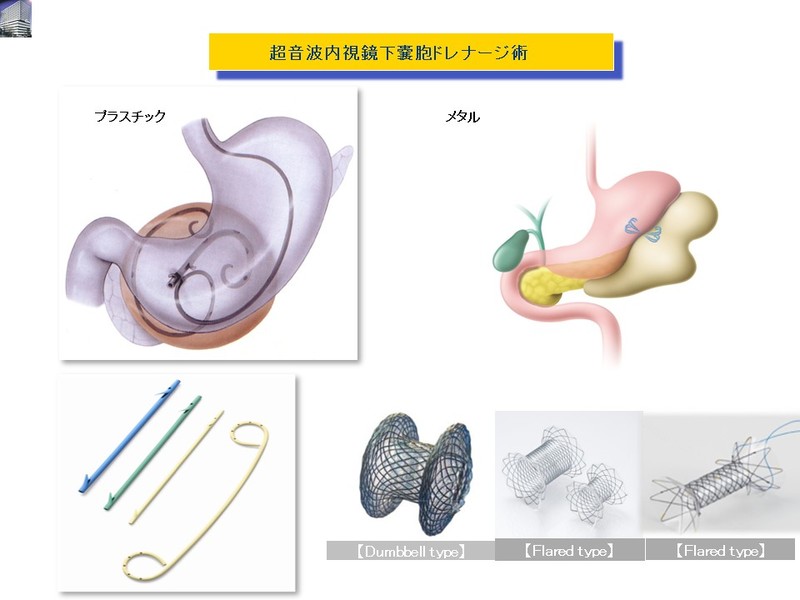 糸井隆夫先生内視鏡ドレナージ術