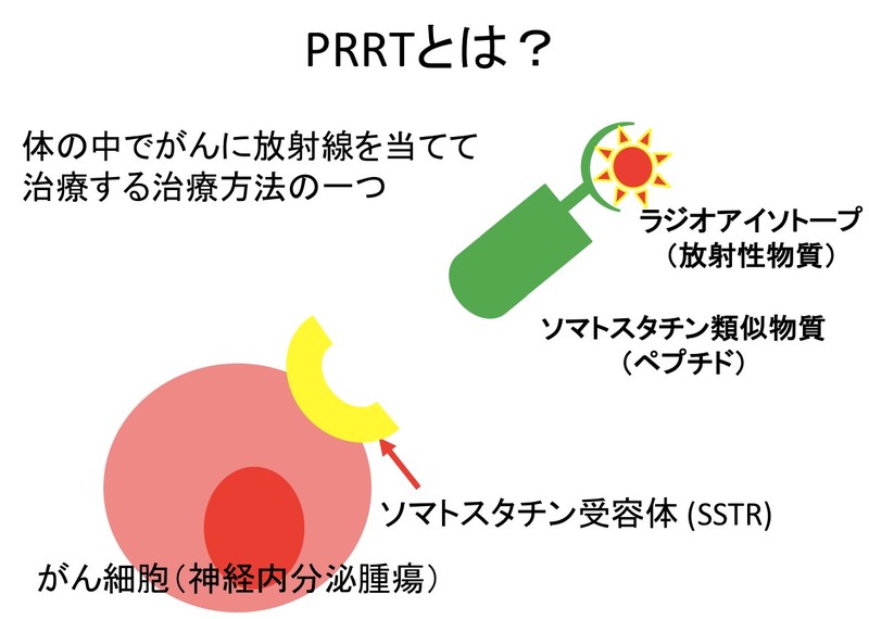 PRRTとは