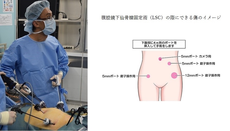 腹腔鏡下手術(提供石川哲也先生)