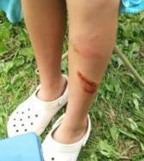 Middle 78ztrvd6mbmnpun2usgvsq