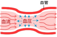 高血圧進行の様子1