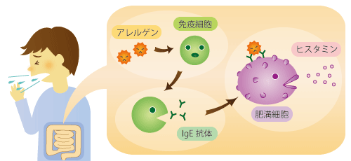 花粉症のメカニズム