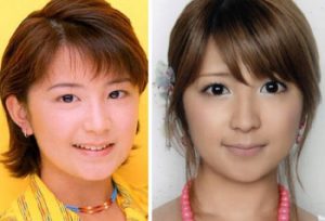矢口真里整形で目が何度も変わる!復帰も変貌が気になる!
