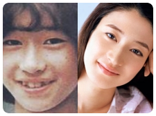 芸能人の今と昔②