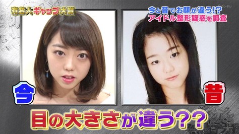 AKB峯岸みなみ整形疑惑の真相は?有名人ギャップ大賞でカミングアウトか?|☆カラフル通信☆