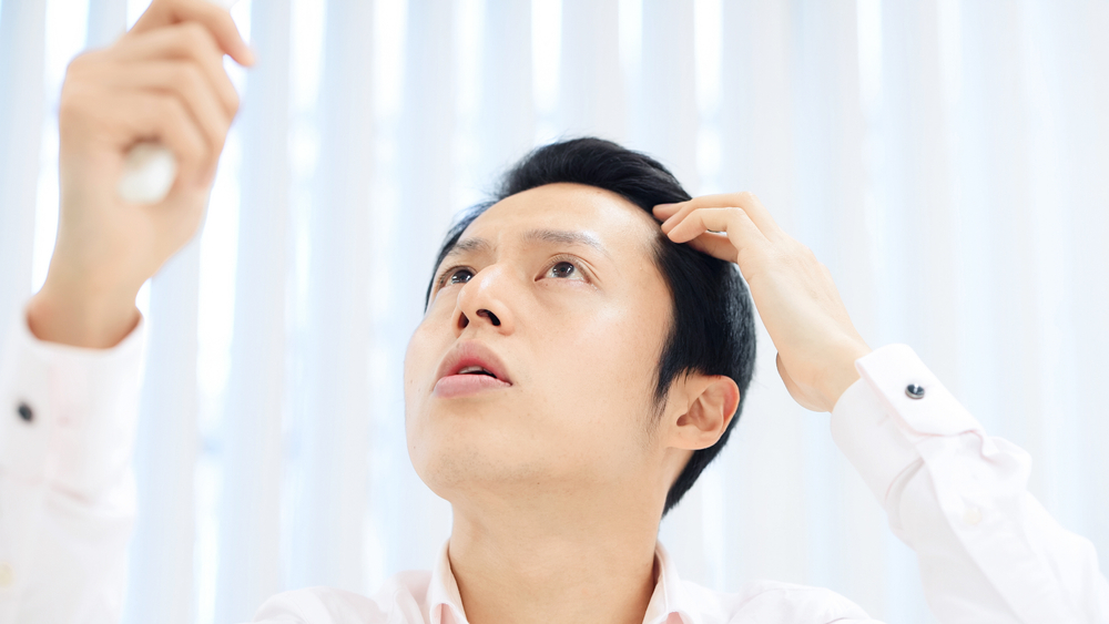 薄毛を気にする男性