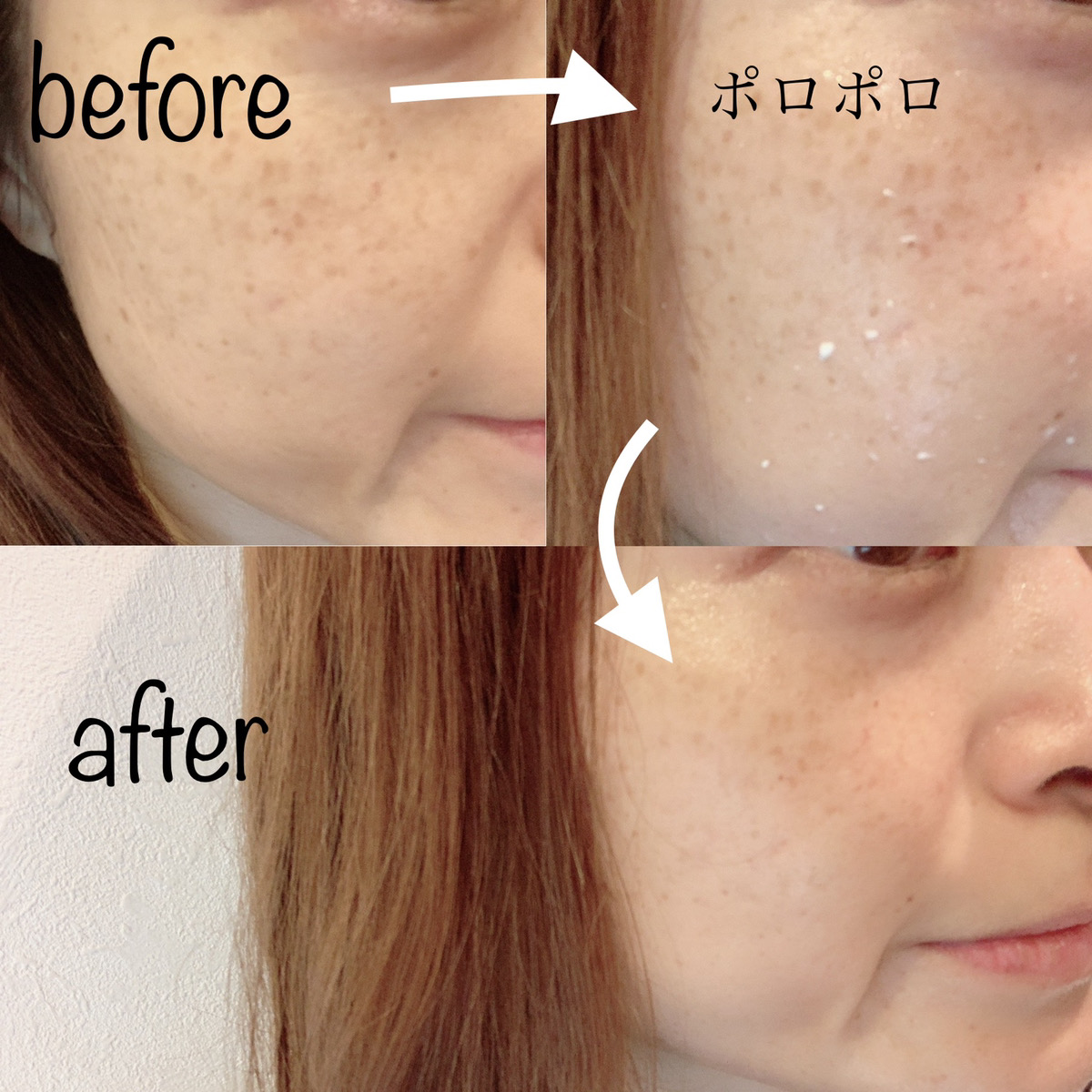 杏ジェルビフォアアフター顔