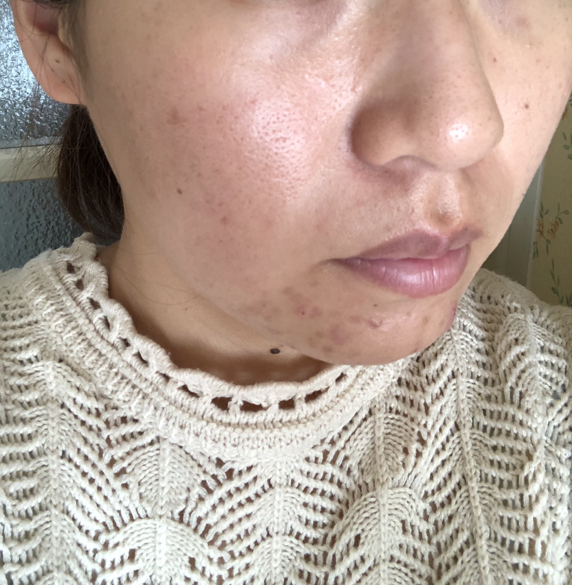 脱毛穴 イルチブラックソープ洗顔の気になる効果は 実際試した感想や口コミをリサーチ Yoga Hack ヨガハック 自分らしいココロとカラダを作る