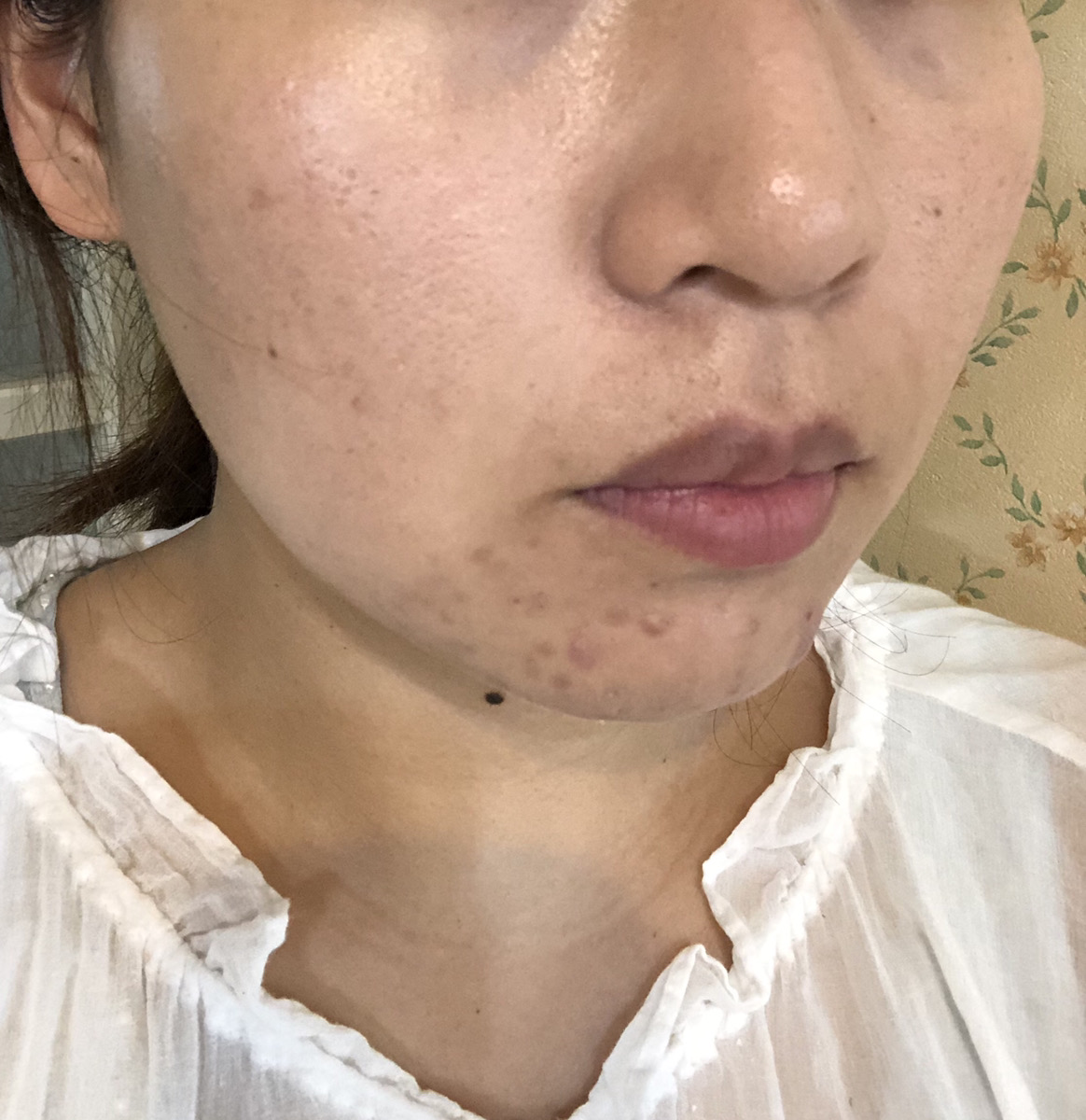 脱毛穴 イルチブラックソープ洗顔の気になる効果は 実際試した感想や口コミをリサーチ Yoga Hack ヨガハック 自分らしいココロとカラダを作る