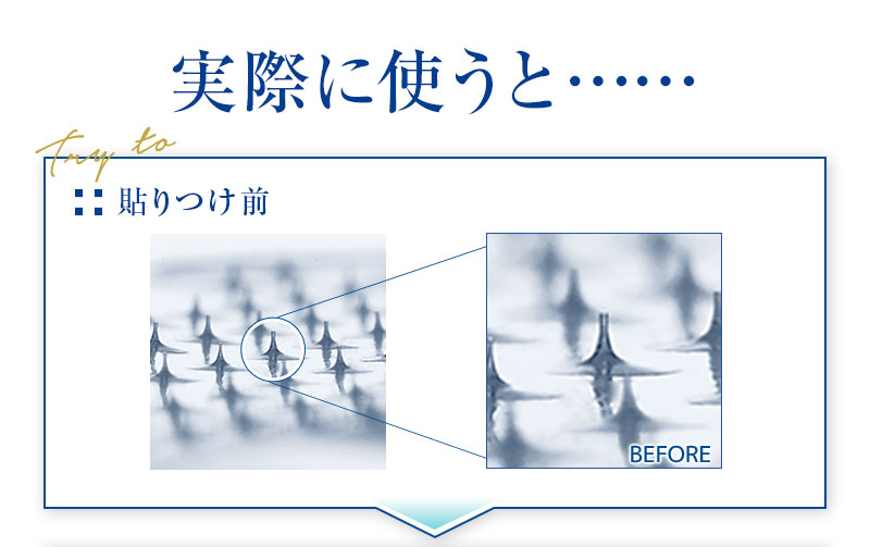ミケンディープパッチ針部分