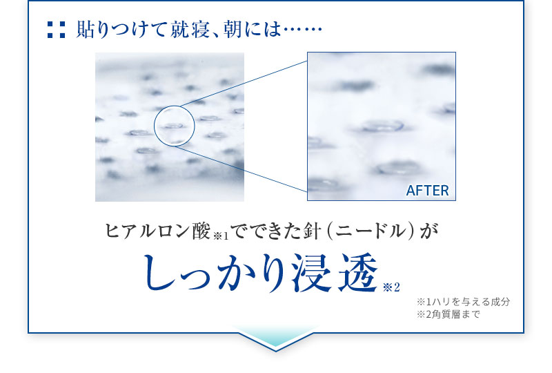 ミケンディープパッチ針使用後