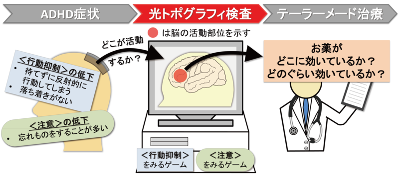 光ポトグラフィー検査