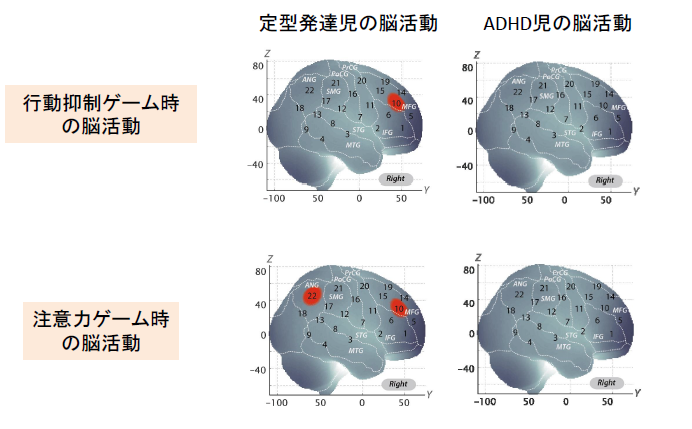 光ポトグラフィー