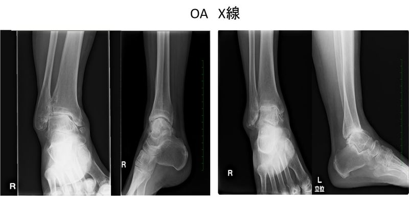 安達先生ご提供資料