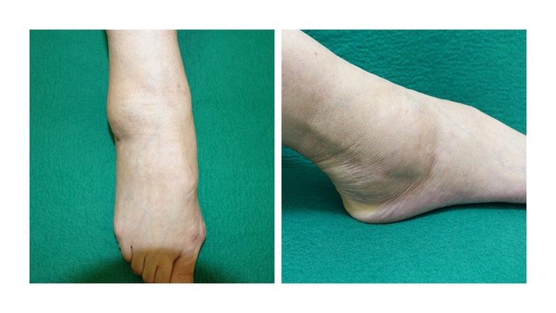 安達先生　症例写真