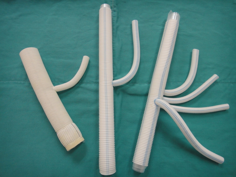 人工血管置換術